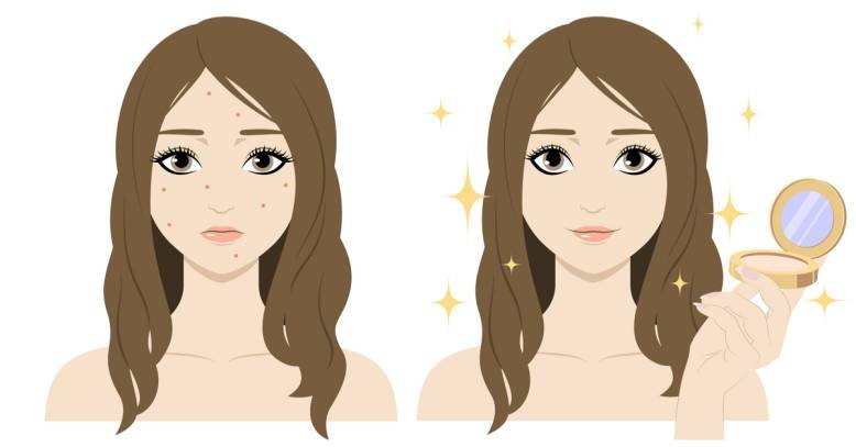 Concealers for acne, before and after, best brands