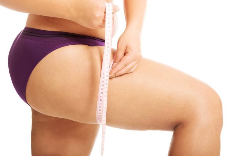 Leg and thigh fats causes, liposuction