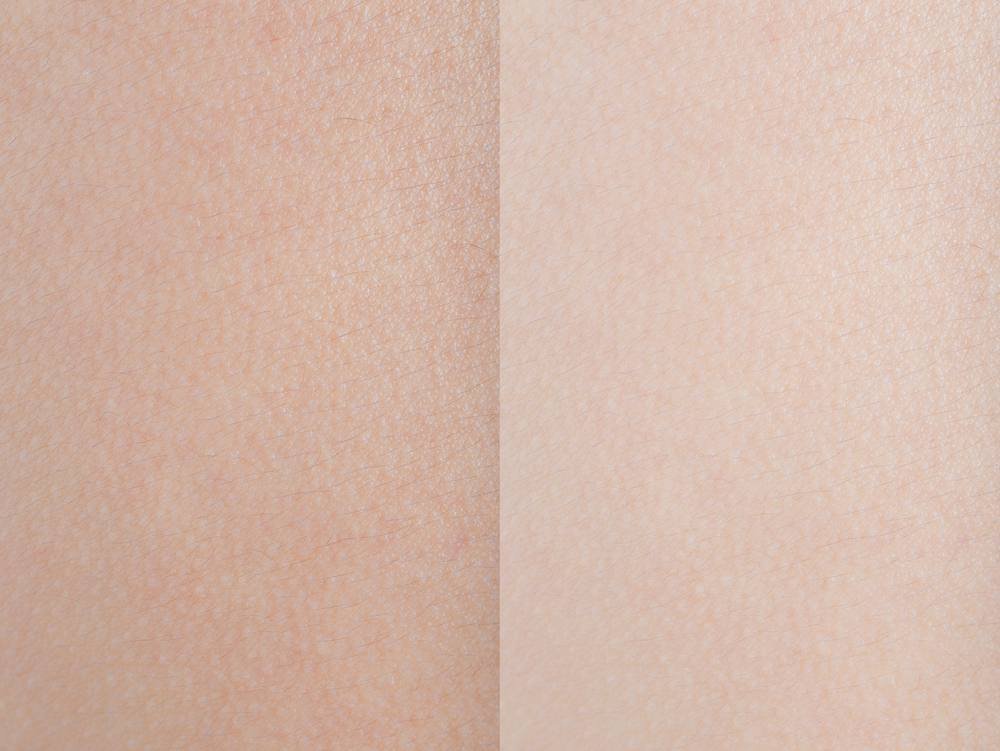 Best Skin Lightening Soaps, for Sensitive Skin - What to Avoid or Look for