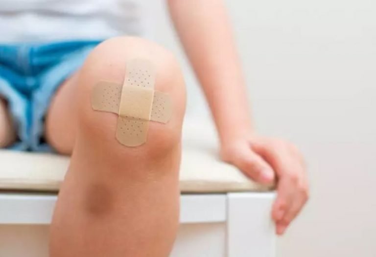 How to Heal a Wound Faster Remedies that Work Best